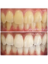 ホワイトニングルーム 横浜店(Whitening Room)/ホワイトニング/横浜