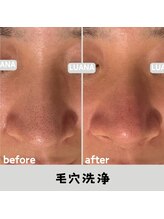 ルアナ 北谷店/毛穴洗浄毛穴ケア 《沖縄/北谷》