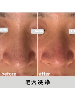 ルアナ 北谷店/毛穴洗浄毛穴ケア 《沖縄/北谷》