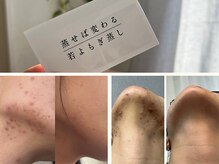 エフブンノイチ(1/f.)の雰囲気（繰り返す大人ニキビならお任せください！生理のお悩みも◎）