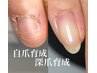 【自爪育成】トラブル爪改善コース★横溝、凹凸、剥離などお悩みの方