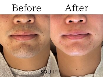 ソウ 野々市店(sou.)/