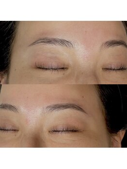 ネネ(nene.)/Hollywood brow lift