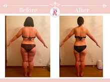 サロン アール(Salon R)/痩身施術×食事・インナーケア