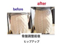 カイロプラクティック よつは/《骨盤矯正前後》