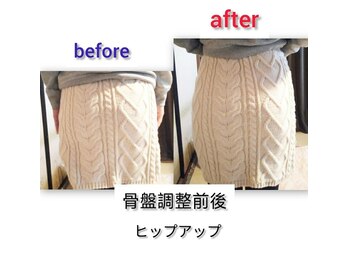 カイロプラクティック よつは/《骨盤矯正前後》