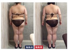 セシオ(SEACIO)/背中もスッキリ♪