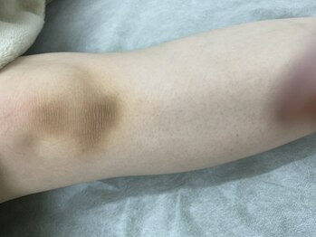 ナノハナ/鹿沼市全身脱毛美容室ナノハナ