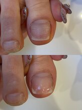 キラネイル アンド アイラッシュ by World Beauty(KIRA)/ペディグラス　見た目も綺麗