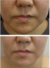 ジオリッチシフォン(giorich chiffon)/【人気1位】コラマジ1回→当日