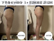 シーフェイス 横浜店(SEE FACE)/下半身ゼロダイエットモニター様