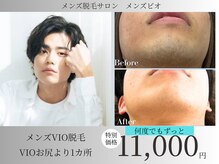 メンズビオ 神戸三宮店の雰囲気（セレクト陰部脱毛1回11,000円～ツルツル！都度払いで何度でも♪）