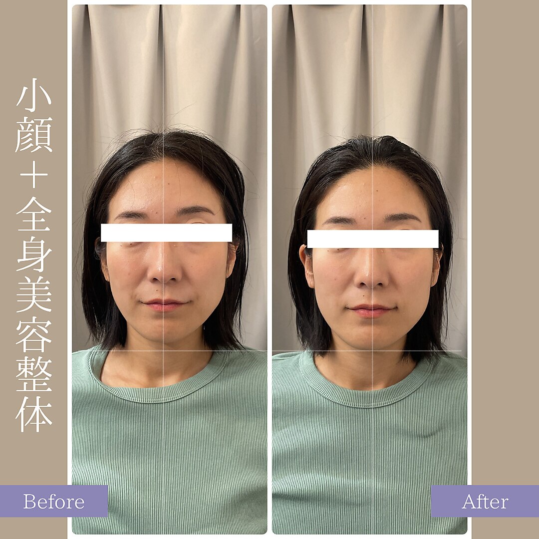 ゆき様　専用ページ　セブチペンライト Beelink Intel Mini PC SEI14| Mini Computers Core Ultra 5 125H Turb