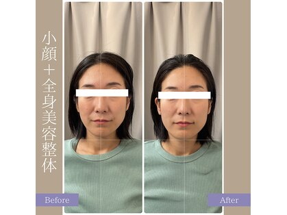 キアラ(chiara)の写真