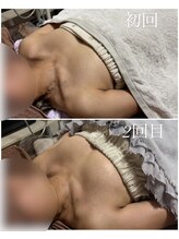 エース(A)/デコルテからふっくらバスト