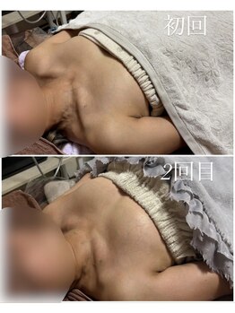 エース(A)/デコルテからふっくらバスト