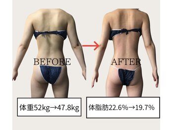 ネオボディ(Neo Body)/ブライダルもお任せください◎