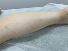 ナノハナ/鹿沼市全身脱毛美容室ナノハナ