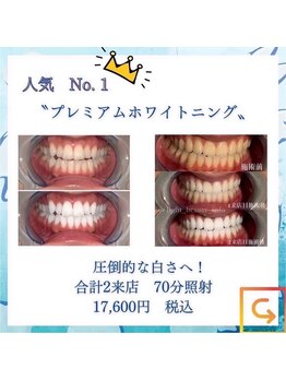 ライトビューティー 恵比寿店(LightBeauty)/人気No. 1メニュー☆