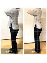 リンドール(RinDoll)/ダイエット/痩身/耳つぼ