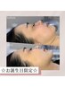 【6月生まれの方】最強3D小顔フェイシャル〈選べる美容液導入プレゼント☆〉
