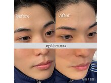 シツ(SHITSU)/症例【before・after】眉毛Wax