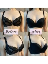 ハイファイブ(Hi-Five)/バストアップ/施術10回