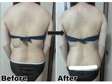 カピリナ(Kapilina)/ WINBACK60 1回【20代後半女性】