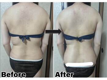 カピリナ(Kapilina)/ WINBACK60 1回【20代後半女性】