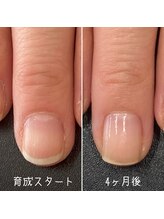 ネイルズ アヴァンティ(Nails Avanti)/割れやすい爪を育成4ヶ月コース