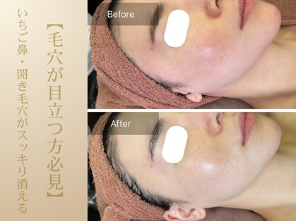 リラクゼーションサロン ラキ(laki)の写真