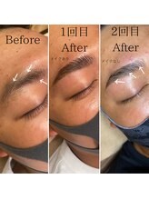 ビトタン 倉敷本店(+美to鍛)/毎月メンテナンスでイケメンに★