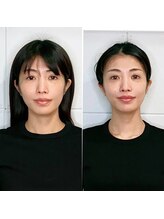 オリノ(Olino)/目もぱっちり可愛く♪