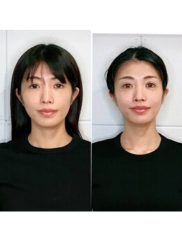 オリノ(Olino)/目もぱっちり可愛く♪