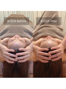 スリージー/before/after