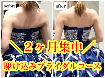 リミー 東大宮店(REME)/全身７部位から組み合わせ自由！