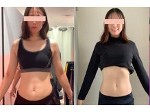 ボディアーキ 高知大丸店(BODY ARCHI)/お腹のbefore・after（正面）