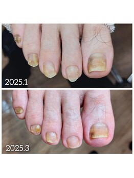 爪切り屋 足楽/