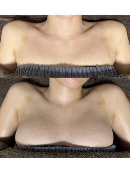 サロン ド ヴィーナス ビューティー(salon de Venus beaute)/美乳/育乳/ボンボンバスト