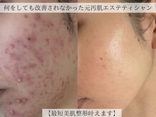 プラウディア(PROUDIA)の雰囲気（20代～60代大人気ダイエット/痩身エステ/ハーブピーリング/痩身）