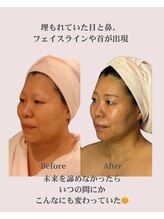 アンジェリカ(Angelica)/埋もれていた目、鼻、輪郭が出現