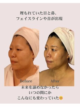 アンジェリカ(Angelica)/埋もれていた目、鼻、輪郭が出現