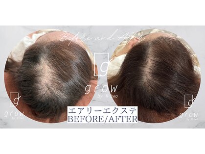 頭皮ケア専門サロン グロウ(grow by k-two)の写真