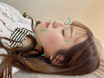 なぎのき鍼灸治療院の写真/【美容も不調も欲張りに♪】コリを集中ケア×美肌を叶える★重い気分もリフレッシュ!毎日明るい自慢の肌へ!