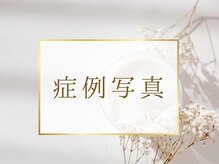 マイナプラ 表参道(myna+)/症例写真