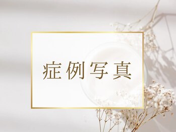 マイナプラ 表参道(myna+)/症例写真