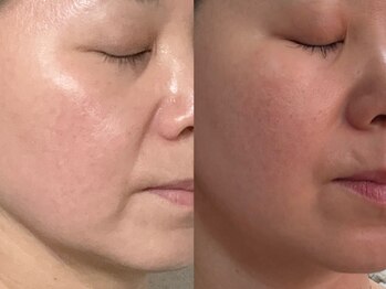 フェリス(FELIZ)/落ちにくいお顔のにくいお肉