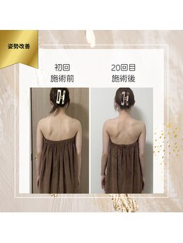 ロココ 町田店(Rococo)/肩甲骨、肋骨が締まりすっきり!