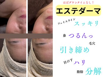 トリビュート(Tribute)/エステダーマ