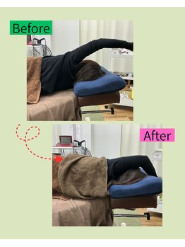 楽する鍼灸 整骨院 南福岡院/